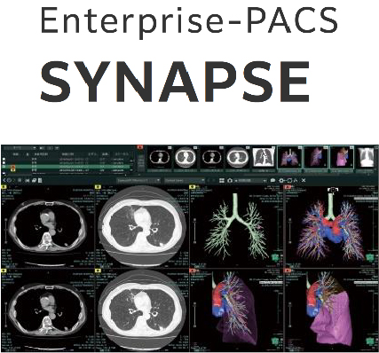 Enterprise-PACS SYNAPSE